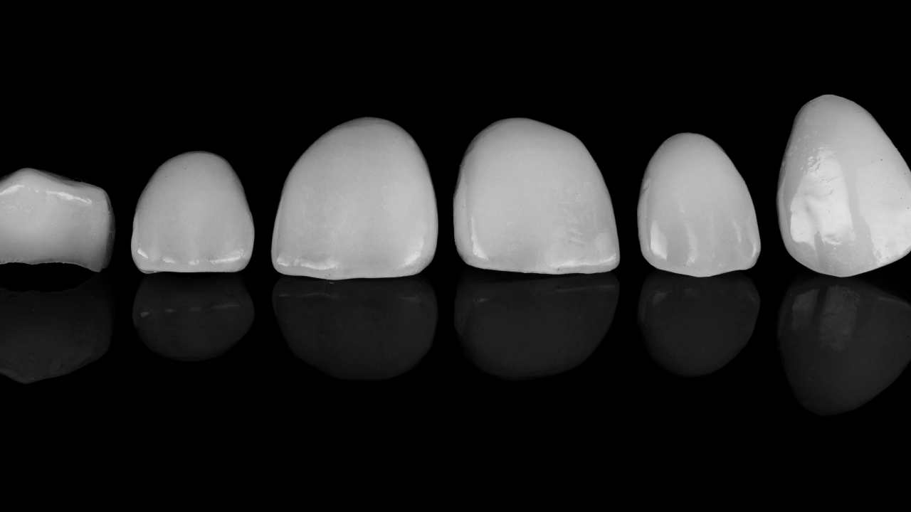 a set of dental veneers on a black background