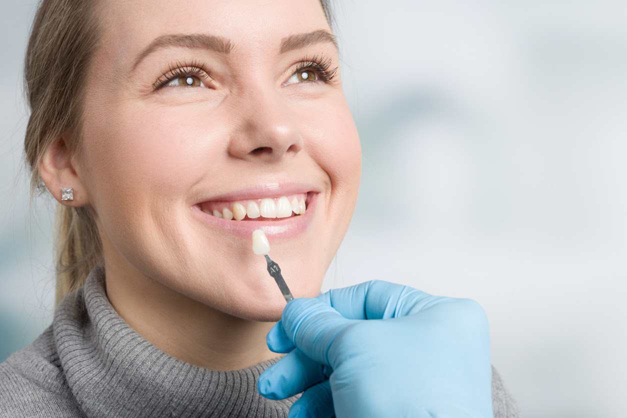 What Are Dental Veneers Procedure, Cost, and Benefits Flatiron