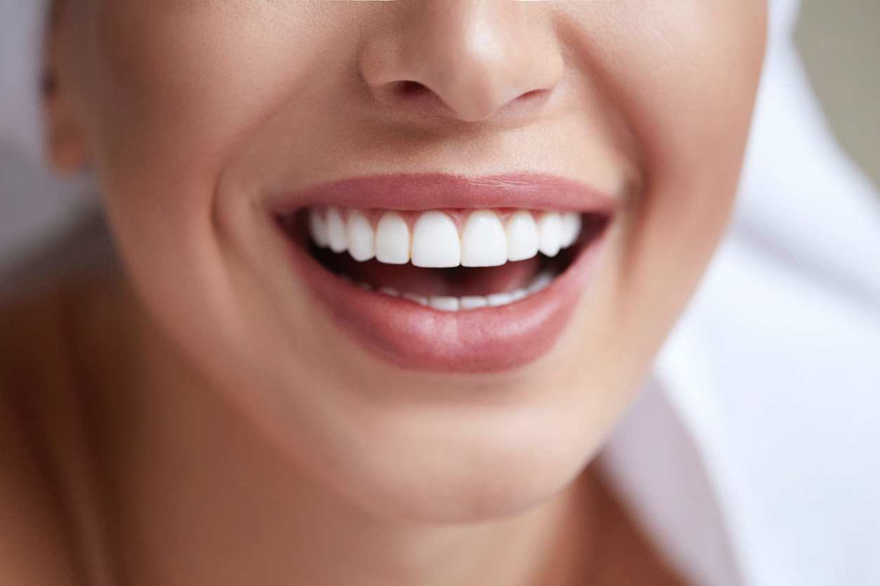 woman with a healthy white teeth smiling