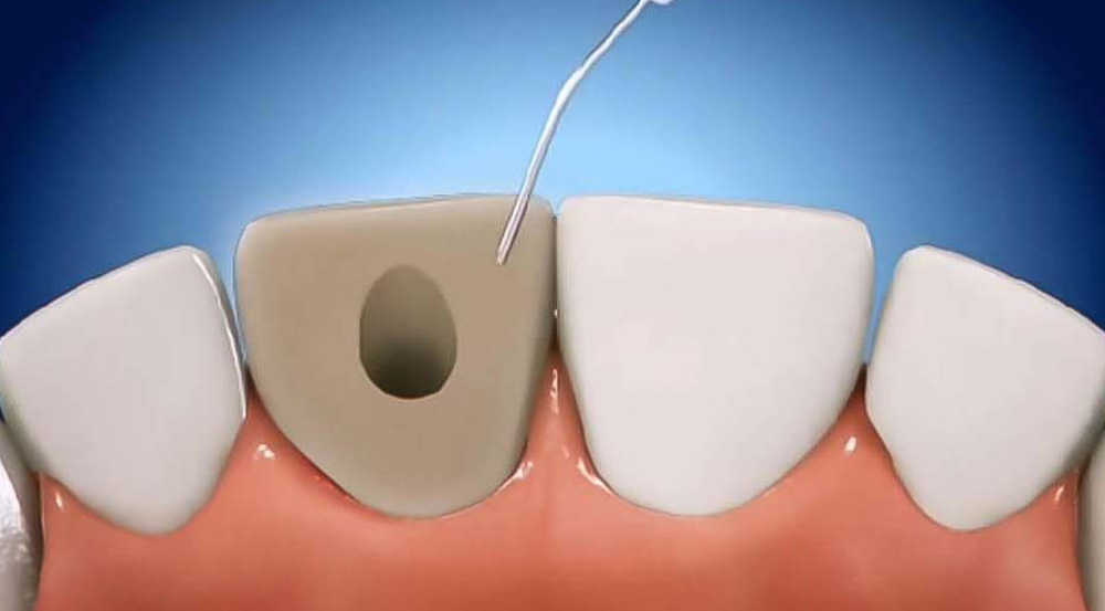 oral-surgery-graphic